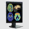  IPO Technologie: Medical Division - Color Diagnostic monitor