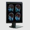  IPO Technologie: Medical Division - Color Diagnostic monitor